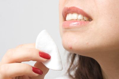 women treating acne on her chin with a cleansing pad