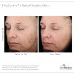 SkinMedica skincare vitalize chemical peel series clinical studies before and after