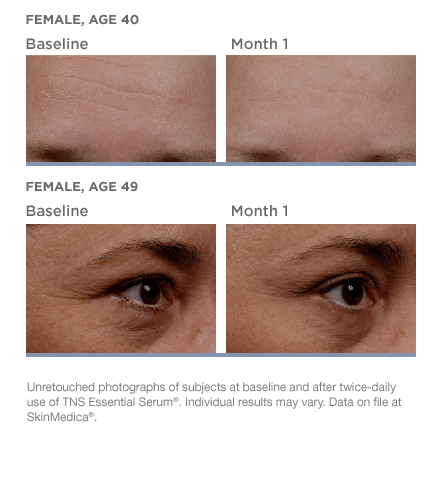 SkinMedica skincare TNS Essential Serum clinical studies before and after