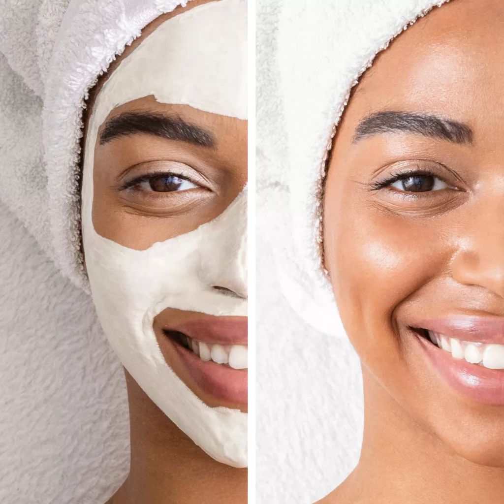 before and after facial treatment
