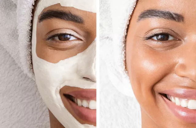 before and after facial treatment