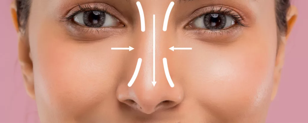 diagram explaining how rhinoplasty (nose surgery) can correct or alter the appearance of your nose