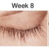 Latisse eyelash treatment serum results week after week