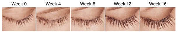 Latisse eyelash treatment serum results week over week