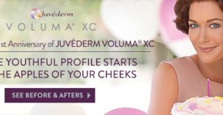 Juvederm Voluma 1st anniversary