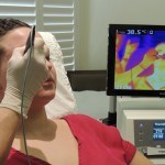 Esthetician using thermismooth facial treatment on client's forehead