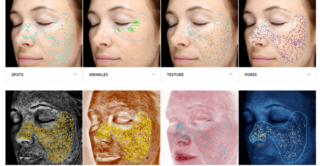 Skin Care Analysis at artemedica in sonoma county