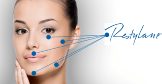 infographic describing best areas to target with Restylane