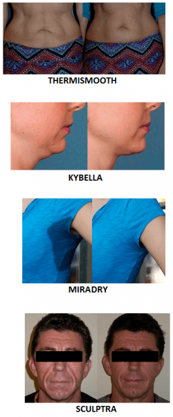 before and after various cosmetic procedures