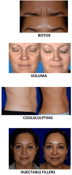 before and after various cosmetic surgery procedures