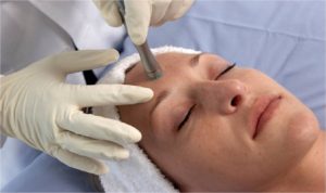 esthetician administering microdermabrasion treatment