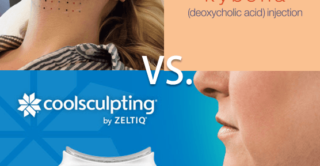 kybella coolsculptin double chin treatment