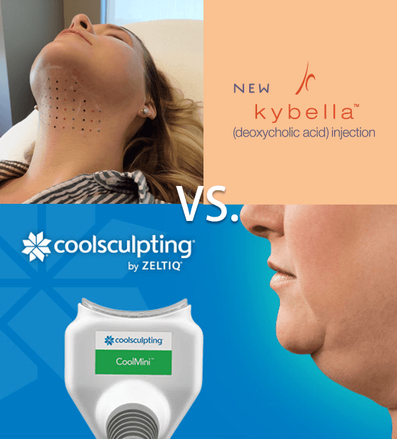 kybella and coolsculpting to treat double chins available at artemedica