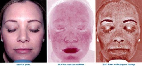 skin analysis of woman's face