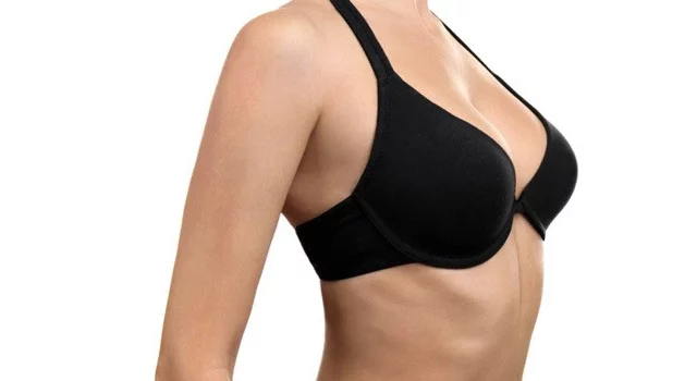 upper torso of woman in black bra after Breast Lift Mastopexy