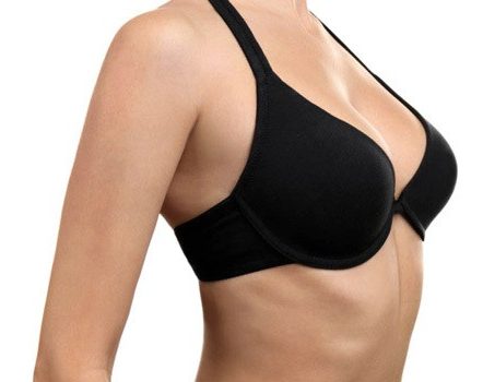 woman's torso in black bra after Breast Lift Mastopexy at artemedica in sonoma county