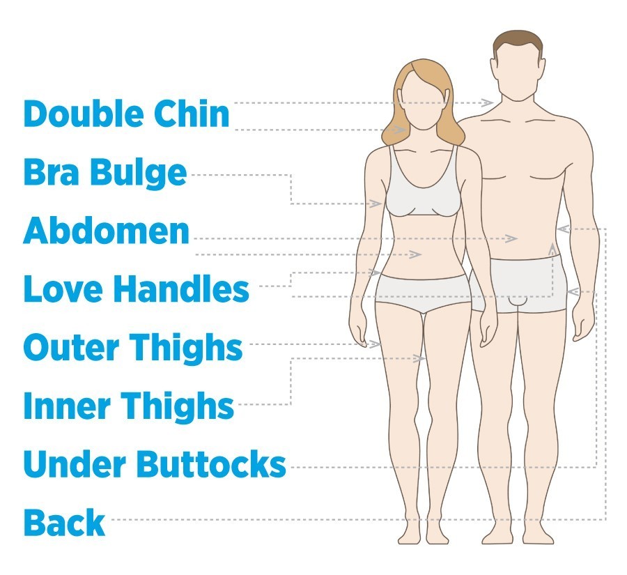 infographic describing best areas to target with coolsculpting