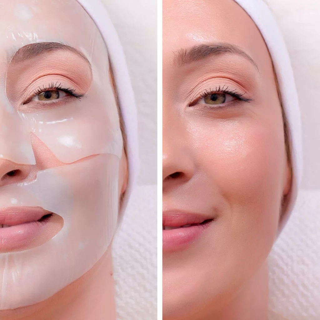 before and after collagen mask add-on service