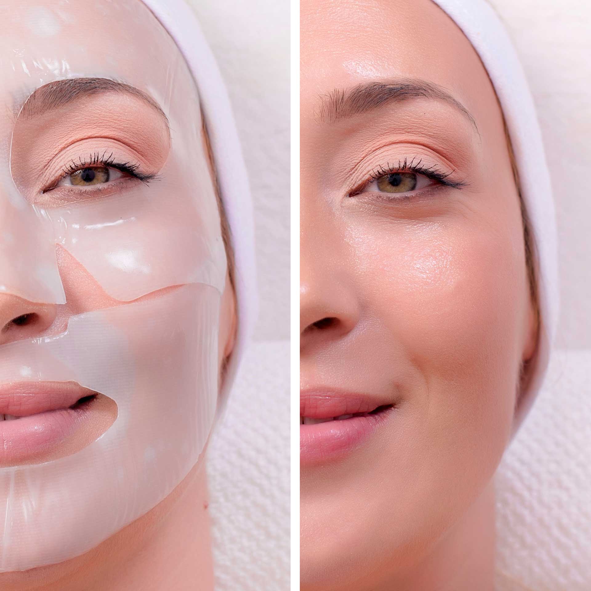 Collagen Treatment Masks - Medical-grade Skincare - Santa Rosa