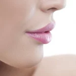closeup of woman's lips after successful lip filler injections at artemedica in sonoma county