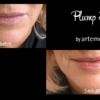 before and after artemedica client uses artemedica makeup plump + tint lip serum