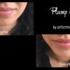 before and after artemedica client uses artemedica makeup plump + tint lip serum