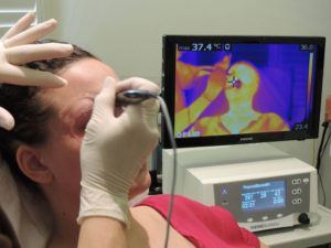 esthetician administers thermismooth to patient's forehead