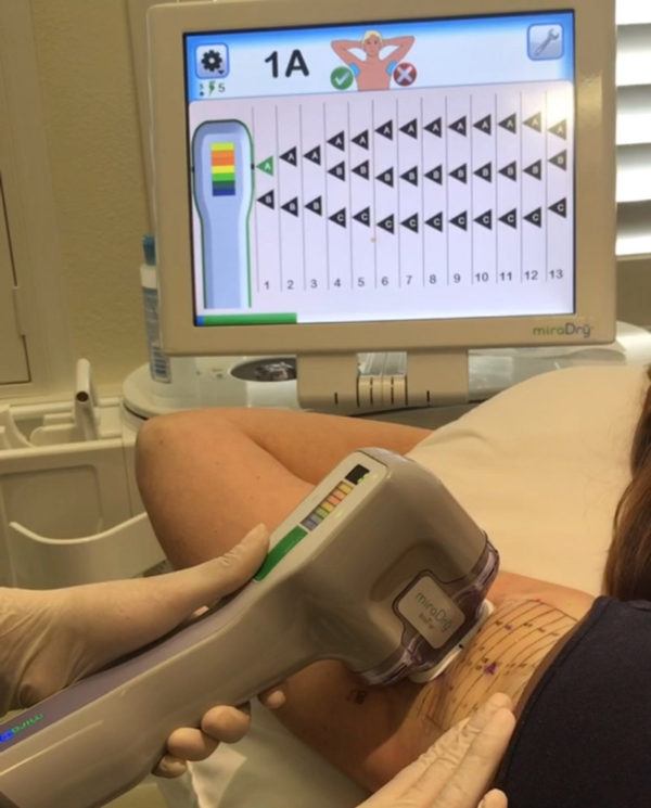 Stop Sweat for Good with miraDry at Artemedica