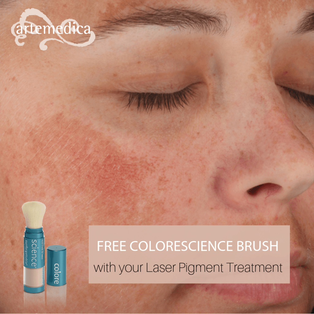 get free colorescience brush with purchase of laser pigment treatment