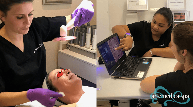 esthetician administering chemical peel at artemedica in sonoma county