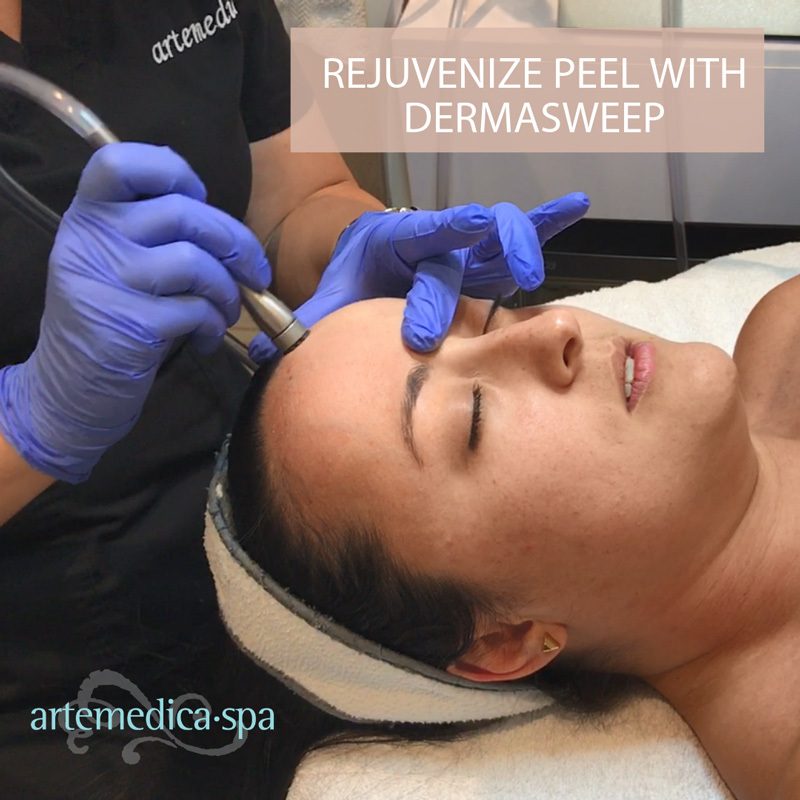 Dermasweep skin care treatment with chemical peel