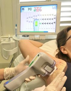 esthetician administering miraDry