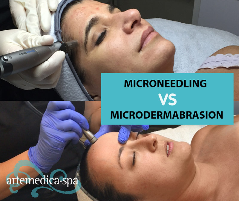 two women receiving microdermabrasion and microneedling skin care treatments at artmedica