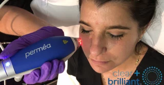 woman receiving laser skin care treatment clear and brilliant permea
