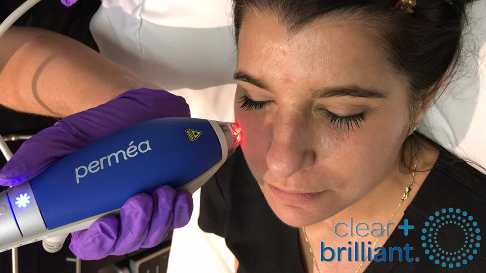 woman receiving laser skin care treatment clear and brilliant permea