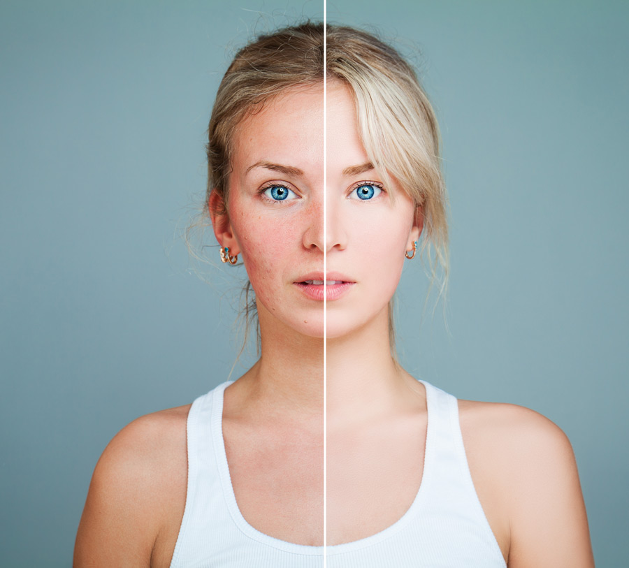 woman's face showing results of laser skin care