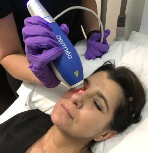 esthetician administering clear + brilliant laser treatment