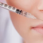 woman receiving botox on her upper lip