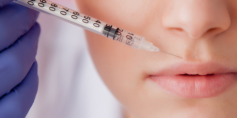 woman receiving botox on her upper lip