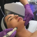 Esthetician using HydraFacial MD facial treatment on client's cheek