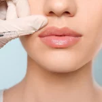 Close up of bottom half of young womens face as she gets lip injections from a doctor