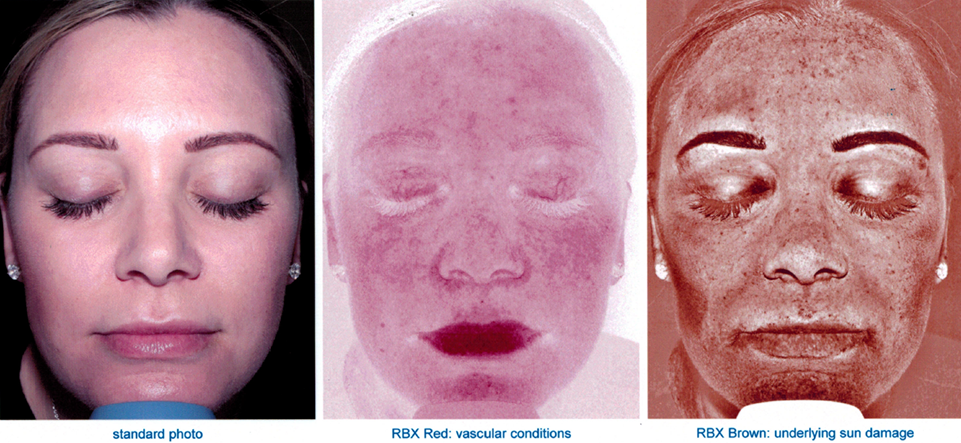 three photos of a women's face showing different skin textures and conditions