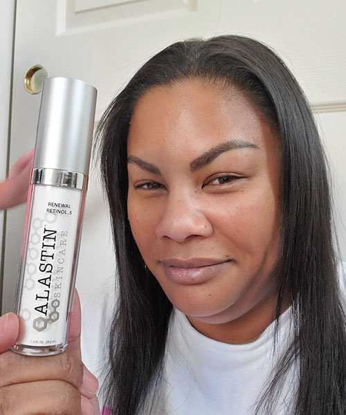Lindsay fighting aging & blemishes with Retinol Renewal