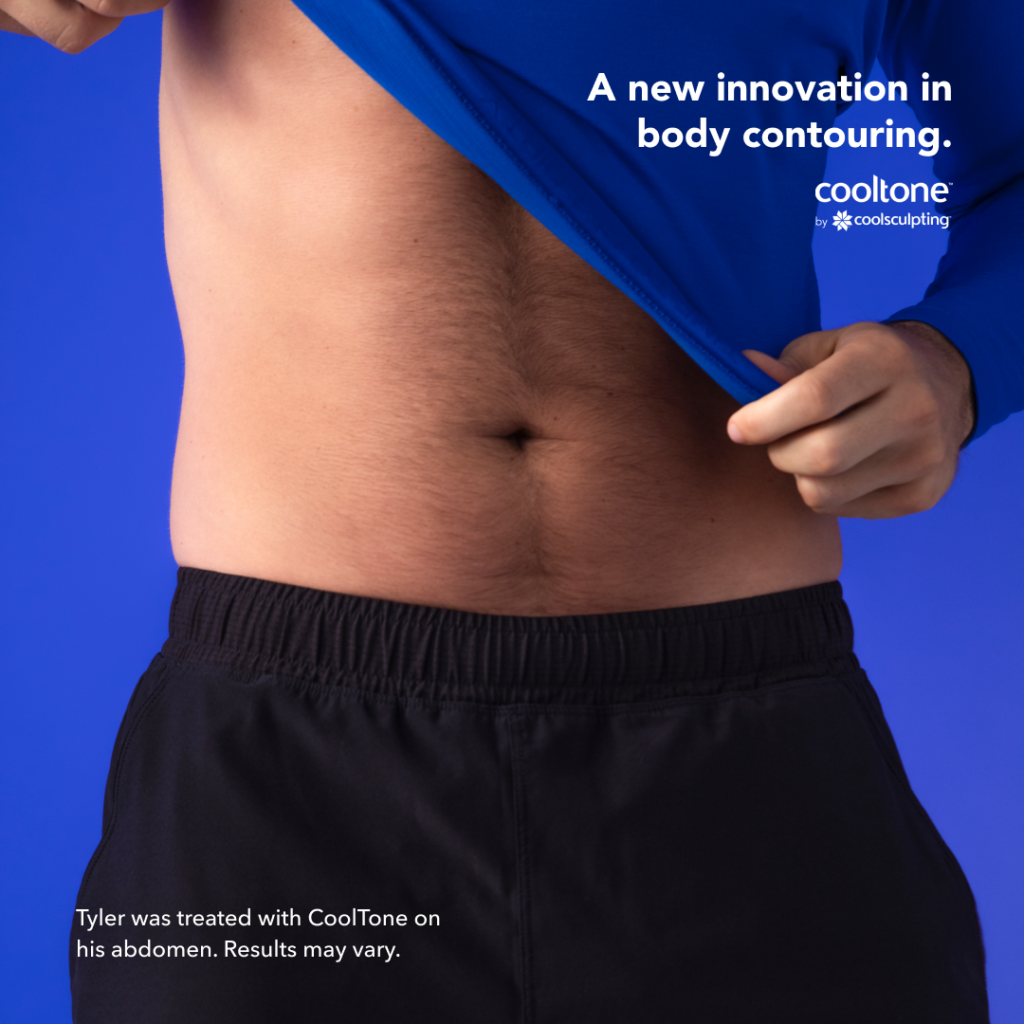 August Coolsculpting & Cooltone results