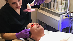 Artemedica client receiving chemical peels