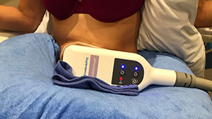 Artemedica client undergoing coolsculpting