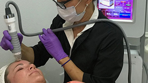 Esthetician using vivace microneedling facial treatment on client's forehead