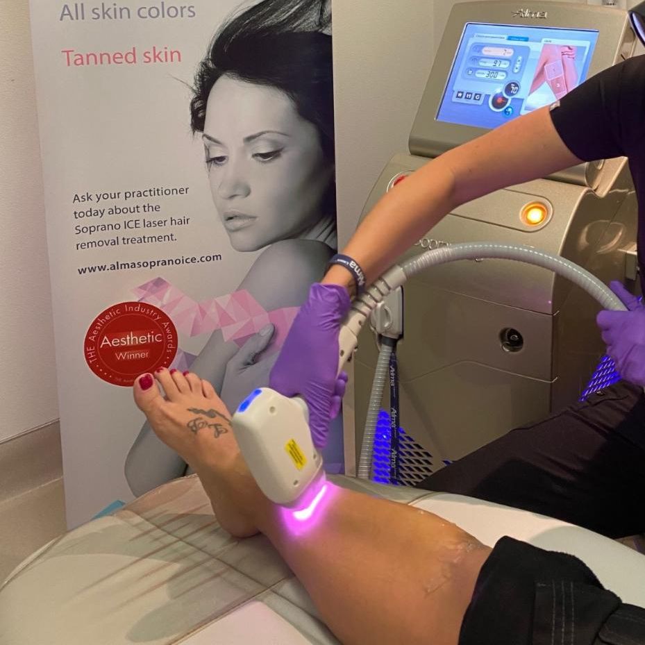 laser hair removal