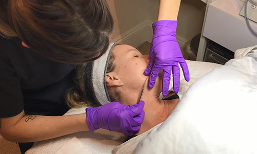 Esthetician using dermaplaning with vitalize peel facial treatment on client's cheek