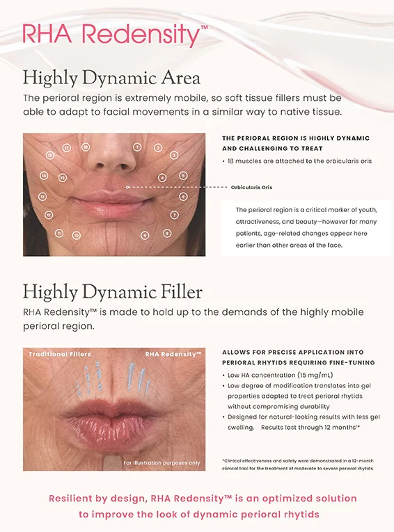 RHA Redensity lip wrinkle filler treatment information detailing the treatment areas around the upper and lower lips 